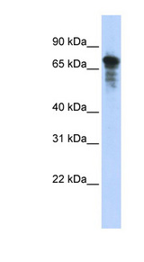 RHPN1 / RHOPHILIN Antibody - RHPN1 antibody Western blot of Transfected 293T cell lysate. This image was taken for the unconjugated form of this product. Other forms have not been tested.