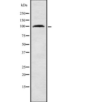 RHPN1 / RHOPHILIN Antibody - Western blot analysis of RHPN1 using LOVO cells whole cells lysates