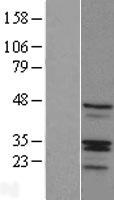 RIBC1 Protein - Western validation with an anti-DDK antibody * L: Control HEK293 lysate R: Over-expression lysate