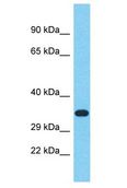 RIBC2 Antibody - RIBC2 antibody Western Blot of 721_B. Antibody dilution: 1 ug/ml.  This image was taken for the unconjugated form of this product. Other forms have not been tested.