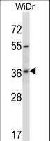 RIBC2 Antibody - RIBC2 Antibody western blot of WiDr cell line lysates (35 ug/lane). The RIBC2 antibody detected the RIBC2 protein (arrow).