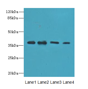 RIBC2 Antibody - Western blot. All lanes: RIBC2 antibody at 0.8 ug/ml. Lane 1: HeLa whole cell lysate. Lane 2: Mouse gonadal tissue. Lane 3: A549 whole cell lysate. Lane 4: Caco-2 whole cell lysate. Secondary Goat polyclonal to Rabbit IgG at 1:10000 dilution. Predicted band size: 37 kDa. Observed band size: 37 kDa.
