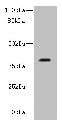 RIBC2 Antibody - Western blot All lanes: RIBC2 antibody at 0.8µg/ml + Caco-2 whole cell lysate Secondary Goat polyclonal to rabbit IgG at 1/10000 dilution Predicted band size: 38 kDa Observed band size: 38 kDa