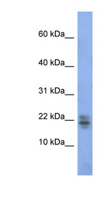 Ribonuclease A / RNASE1 Antibody - RNASE1 / Ribonuclease A antibody Western blot of Fetal Kidney lysate. This image was taken for the unconjugated form of this product. Other forms have not been tested.
