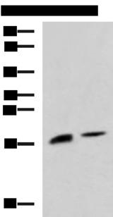 Ribonuclease A / RNASE1 Antibody - Western blot analysis of Rat pancreas tissue and Mouse pancreas tissue lysates  using RNASE1 Polyclonal Antibody at dilution of 1:650