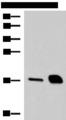 Ribonuclease A / RNASE1 Antibody - Western blot analysis of Mouse pancreas tissue and Rat pancreas tissue lysates  using RNASE1 Polyclonal Antibody at dilution of 1:550