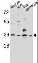 RIC3 Antibody - RIC3 Antibody western blot of NCI-H292,A549,WiDr,MDA-MB453 cell line lysates (35 ug/lane). The RIC3 antibody detected the RIC3 protein (arrow).