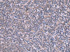 RIC3 Antibody - Immunohistochemistry of paraffin-embedded Human tonsil tissue  using RIC3 Polyclonal Antibody at dilution of 1:90(×200)