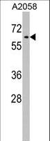 RIC8A Antibody - RIC8A Antibody western blot of A2058 cell line lysates (35 ug/lane). The RIC8A antibody detected the RIC8A protein (arrow).