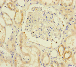 RIC8A Antibody - Immunohistochemistry of paraffin-embedded human kidney tissue at dilution of 1:100