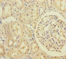 RIC8A Antibody - Immunohistochemistry of paraffin-embedded human kidney tissue at dilution of 1:100