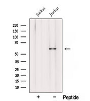 RIC8A Antibody - Western blot analysis of extracts of HepG2 cells using RIC8A antibody. The lane on the left was treated with blocking peptide.