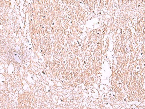 RIC8A Antibody - Immunohistochemistry of paraffin-embedded Human brain tissue  using RIC8A Polyclonal Antibody at dilution of 1:55(×200)