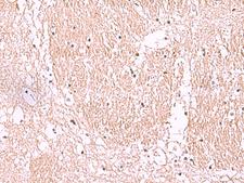 RIC8A Antibody - Immunohistochemistry of paraffin-embedded Human brain tissue  using RIC8A Polyclonal Antibody at dilution of 1:55(×200)