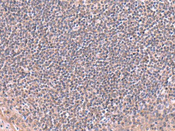 RIC8A Antibody - Immunohistochemistry of paraffin-embedded Human tonsil tissue  using RIC8A Polyclonal Antibody at dilution of 1:80(×200)