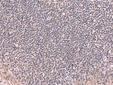 RIC8A Antibody - Immunohistochemistry of paraffin-embedded Human tonsil tissue  using RIC8A Polyclonal Antibody at dilution of 1:80(×200)