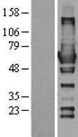 RIC8A Protein - Western validation with an anti-DDK antibody * L: Control HEK293 lysate R: Over-expression lysate