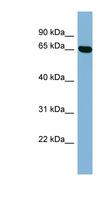 RIC8B Antibody - RIC8B antibody Western blot of Placenta lysate. This image was taken for the unconjugated form of this product. Other forms have not been tested.