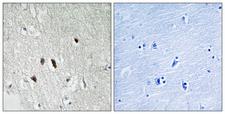 RICK / RIP2 Antibody - Immunohistochemistry analysis of paraffin-embedded human brain tissue, using RIPK2 Antibody. The picture on the right is blocked with the synthesized peptide.
