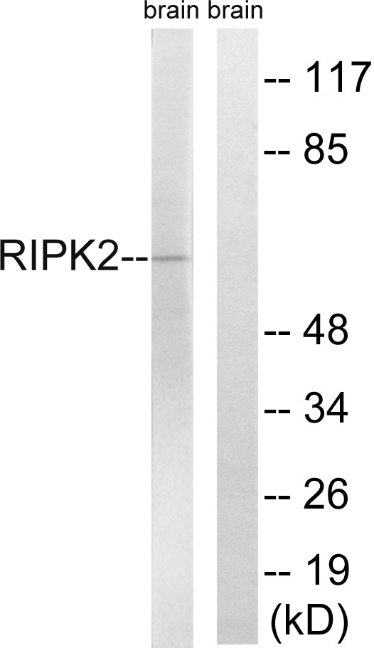 RICK / RIP2 Antibody - Western blot analysis of lysates from rat brain cells, using RIPK2 Antibody. The lane on the right is blocked with the synthesized peptide.