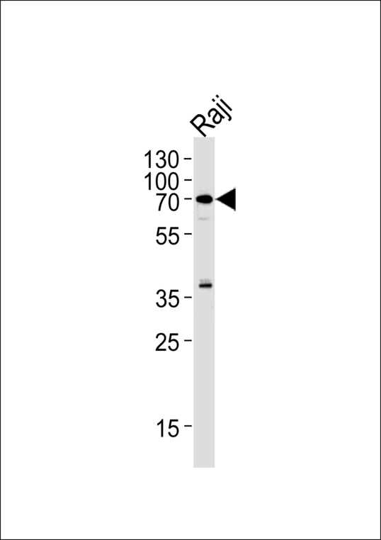 RICK / RIP2 Antibody - RIPK2 Antibody western blot of Raji cell line lysates (35 ug/lane). The RIPK2 antibody detected the RIPK2 protein (arrow).