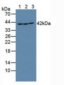 RICK / RIP2 Antibody - Western Blot Sample: Lane1: Mouse Placenta Tissue; Lane2: Rat Placenta Tissue; Lane3: Human K562 Cells.