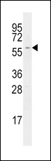 RICK / RIP2 Antibody - Western blot of anti-RIPK2 antibody in Ramos cell line lysates (35 ug/lane). RIPK2 (arrow) was detected using the purified antibody.