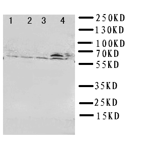 RICK / RIP2 Antibody - WB of RICK / RIP2 / CCK antibody. Lane 1: A549 Cell Lysate. Lane 2: HELA Cell Lysate. Lane 3: PANC Cell Lysate. Lane 4: COLO320 Cell Lysate.