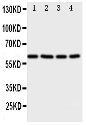 RICK / RIP2 Antibody - Anti-RIP2 antibody, Western blotting All lanes: Anti RIP2 at 0.5ug/ml Lane 1: A549 Whole Cell Lysate at 40ug Lane 2: HELA Whole Cell Lysate at 40ug Lane 3: PANC Whole Cell Lysate at 40ug Lane 4: COLO320 Whole Cell Lysate at 40ug Predicted bind size: 61KD Observed bind size: 61KD