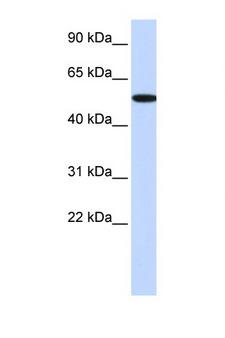 RICK / RIP2 Antibody - RIPK2 / RIP2 antibody Western blot of HepG2 Cell lysate. Antibody concentration 1 ug/ml. This image was taken for the unconjugated form of this product. Other forms have not been tested.