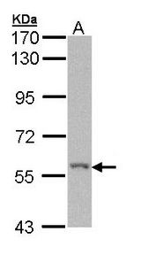 RICK / RIP2 Antibody - Sample (30 ug of whole cell lysate). A: Molt-4. 7.5% SDS PAGE. RIPK2 antibody diluted at 1:1000. 