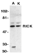 RICK / RIP2 Antibody - Western blot of RICK in A431 (A) and K562 (K) whole cell lysate with RICK antibody at 1 ug/ml.