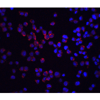 RICK / RIP2 Antibody - Immunofluorescence of RICK in K562 cells with RICK antibody at 20 µg/ml.