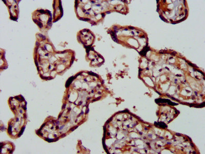 RICK / RIP2 Antibody - IHC image of RIPK2 Antibody diluted at 1:400 and staining in paraffin-embedded human placenta tissue performed on a Leica BondTM system. After dewaxing and hydration, antigen retrieval was mediated by high pressure in a citrate buffer (pH 6.0). Section was blocked with 10% normal goat serum 30min at RT. Then primary antibody (1% BSA) was incubated at 4°C overnight. The primary is detected by a biotinylated secondary antibody and visualized using an HRP conjugated SP system.