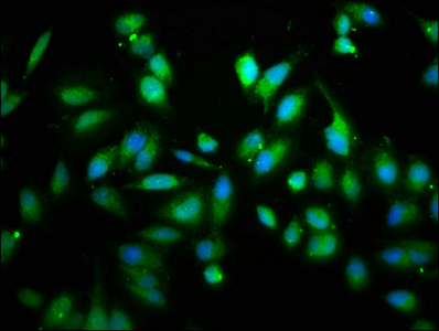 RICK / RIP2 Antibody - Immunofluorescence staining of Hela cells with RIPK2 Antibody at 1:133, counter-stained with DAPI. The cells were fixed in 4% formaldehyde, permeabilized using 0.2% Triton X-100 and blocked in 10% normal Goat Serum. The cells were then incubated with the antibody overnight at 4°C. The secondary antibody was Alexa Fluor 488-congugated AffiniPure Goat Anti-Rabbit IgG(H+L).