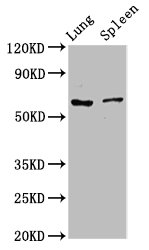 RICK / RIP2 Antibody - Western Blot Positive WB detected in: Rat lung tissue, Rat spleen tissue All lanes: RIPK2 antibody at 2.7µg/ml Secondary Goat polyclonal to rabbit IgG at 1/50000 dilution Predicted band size: 62, 46 kDa Observed band size: 62 kDa