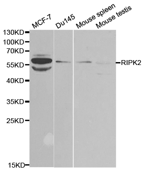 RICK / RIP2 Antibody - Western blot analysis of extracts of various cell lines, using RIPK2 antibody.