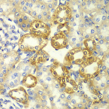 RICK / RIP2 Antibody - Immunohistochemistry of paraffin-embedded rat kidney tissue.