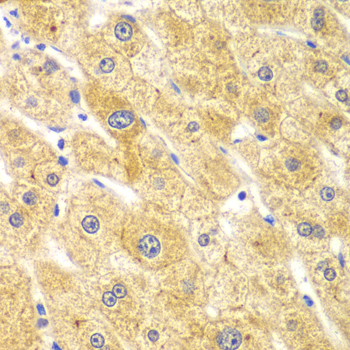 RICK / RIP2 Antibody - Immunohistochemistry of paraffin-embedded human liver injury tissue.