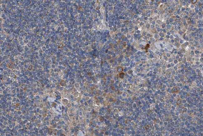 RICK / RIP2 Antibody - 1:200 staining human lymph node tissue by IHC-P. The tissue was formaldehyde fixed and a heat mediated antigen retrieval step in citrate buffer was performed. The tissue was then blocked and incubated with the antibody for 1.5 hours at 22°C. An HRP conjugated goat anti-rabbit antibody was used as the secondary.