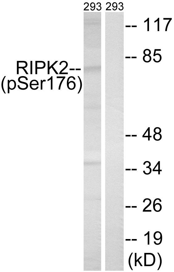 RICK / RIP2 Antibody - Western blot analysis of extracts from 293 cells, treated with UV (15mins), using RIPK2 (Phospho-Ser176) antibody.