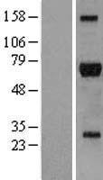 RICK / RIP2 Protein - Western validation with an anti-DDK antibody * L: Control HEK293 lysate R: Over-expression lysate