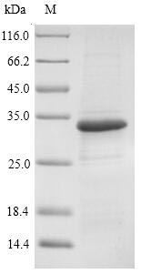 omp Protein - (Tris-Glycine gel) Discontinuous SDS-PAGE (reduced) with 5% enrichment gel and 15% separation gel.