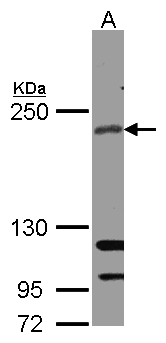 RICTOR Antibody - Sample (30 ug whole cell lysate). A: A431 . 5% SDS PAGE. RICTOR antibody diluted at 1:1000
