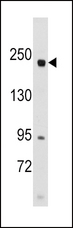 RICTOR Antibody - Western blot of anti-RICTOR antibody in SK-BR-3 cell line lysates (35 ug/lane). RICTOR (arrow) was detected using the purified antibody.