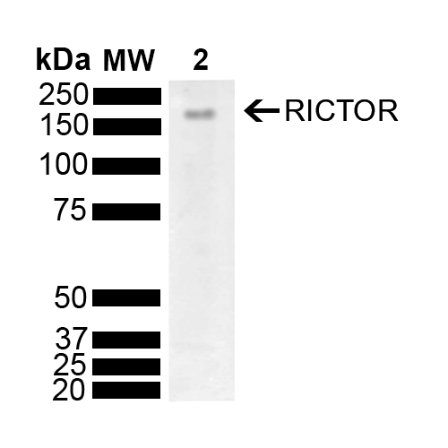 RICTOR Antibody - Western blot analysis of Mouse Brain showing detection of 192 kDa RICTOR protein using Rabbit Anti-RICTOR Polyclonal Antibody. Lane 1: Molecular Weight Ladder (MW). Lane 2: Mouse Brain. Load: 10 µg. Block: 5% Skim Milk powder in TBST. Primary Antibody: Rabbit Anti-RICTOR Polyclonal Antibody  at 1:1000 for 2 hours at RT with shaking. Secondary Antibody: Goat Anti-Rabbit IgG: HRP at 1:5000 for 1 hour at RT. Color Development: ECL solution for 5 min at RT. Predicted/Observed Size: 192 kDa.