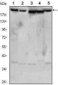 RICTOR Antibody - Western Blot: RICTOR Antibody (7B3) - Western blot analysis using RICTOR mouse mAb against HeLa (1), PANC-1 (2), MOLT4 (3), HepG2 (4) and HEK293 (5) cell lysates.