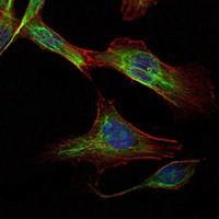 RICTOR Antibody - Immunocytochemistry/Immunofluorescence: RICTOR Antibody (7B3) - Analysis of NIH/3T3 cells using RICTOR mouse mAb (green). Blue: DRAQ5 fluorescent DNA dye. Red: Actin filaments have been labeled with Alexa Fluor-555 phalloidin.