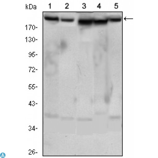 RICTOR Antibody - Western Blot (WB) analysis using Rictor Monoclonal Antibody against HeLa (1), PANC-1 (2), MOLT4 (3), HepG2 (4) and HEK293 (5) cell lysate.