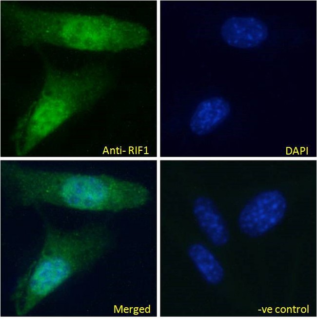 RIF1 Antibody - RIF1 antibody immunofluorescence analysis of paraformaldehyde fixed NIH3T3 cells, permeabilized with 0.15% Triton. Primary incubation 1hr (10ug/ml) followed by Alexa Fluor 488 secondary antibody (2ug/ml), showing nuclear staining. The nuclear stain is DAPI (blue). Negative control: Unimmunized goat IgG (10ug/ml) followed by Alexa Fluor 488 secondary antibody (2ug/ml).